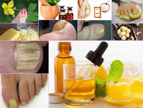 Folk Remedies for Treating Toenail Fungus