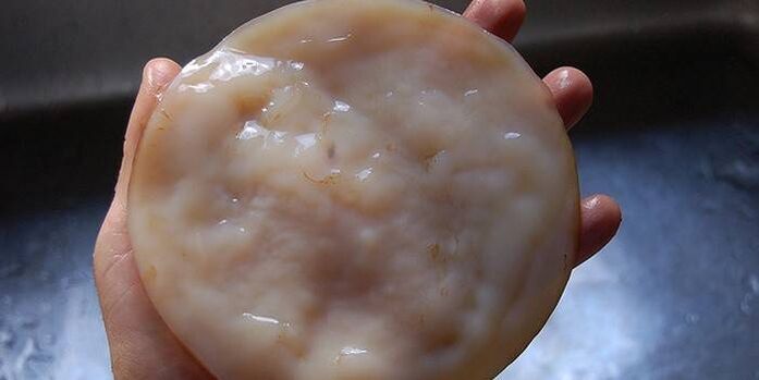 Kombucha treats nail fungus