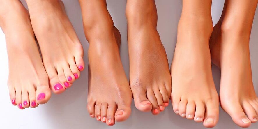 Foot health after onychomycosis treatment