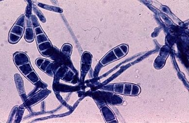 Bacteria cause nail fungi