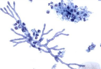 Mold affects nail plates